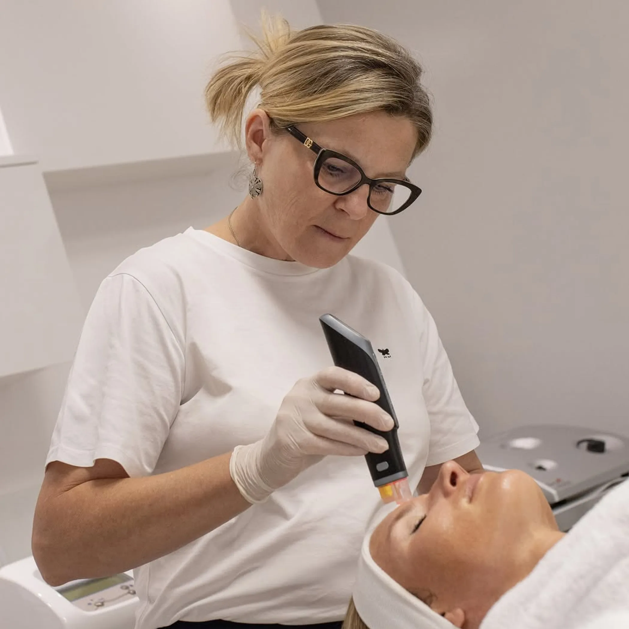 microneedling skin treatment close-up
